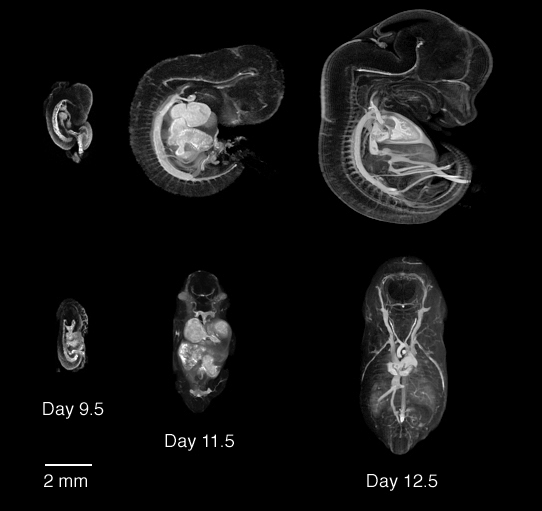 MRI with and without vasculature contrast agent