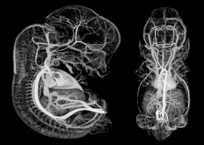 MRI showing vasculature