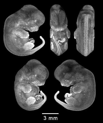 four MRI views of mouse embryo