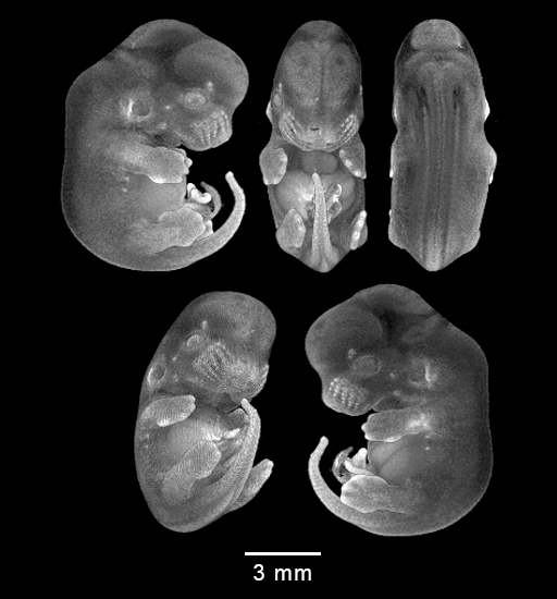 four MRI views of mouse embryo